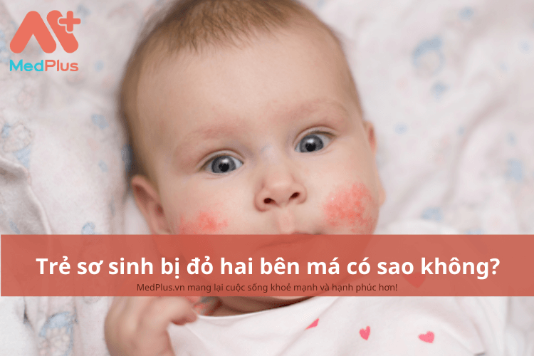 tre so sinh bi do hai ben ma co sao khong 3 - Medplus