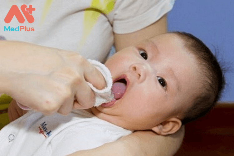 Trẻ sơ sinh bị hôi miệng có sao không?