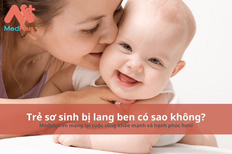 Trẻ sơ sinh bị lang ben có sao không