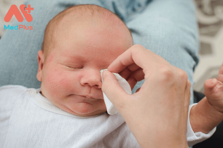 Trẻ sơ sinh bị nổi đỏ ở mặt có sao không?
