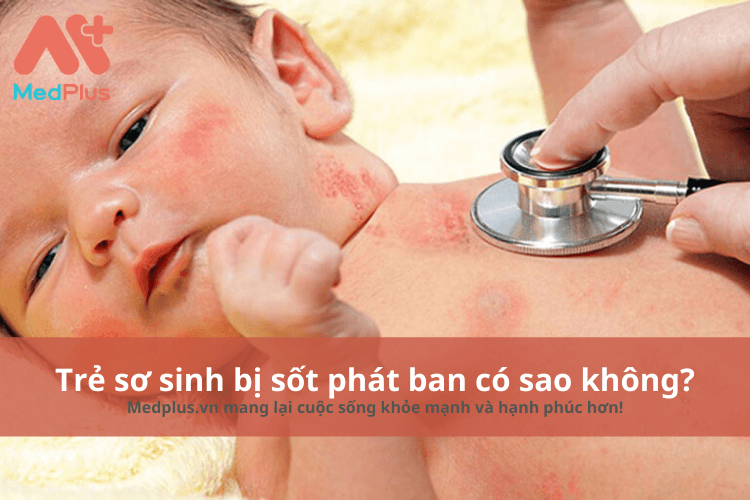 Trẻ sơ sinh bị sốt phát ban có sao không