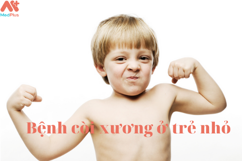 Bệnh còi xương ở trẻ và cách phòng tránh