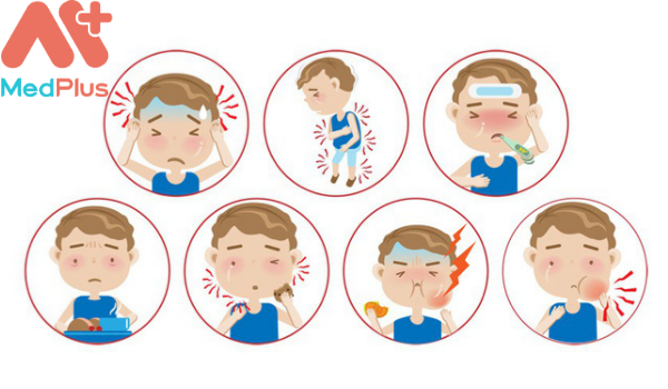 Các triệu chứng của quai bị