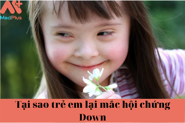 Hội chứng Down có chữa được hay không?