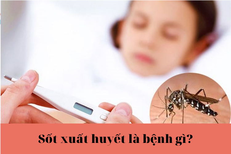 Sot xuat huyet - Medplus
