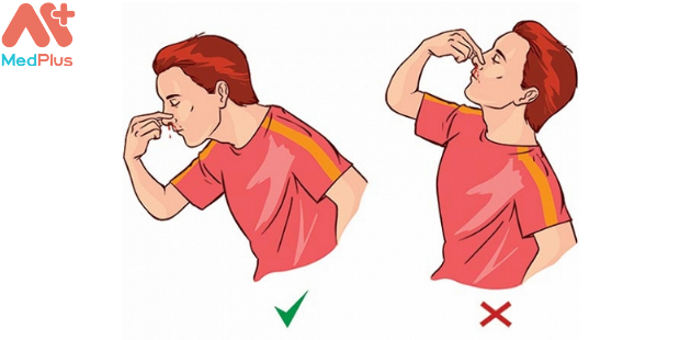Bạn nên làm gì khi chảy máu mũi