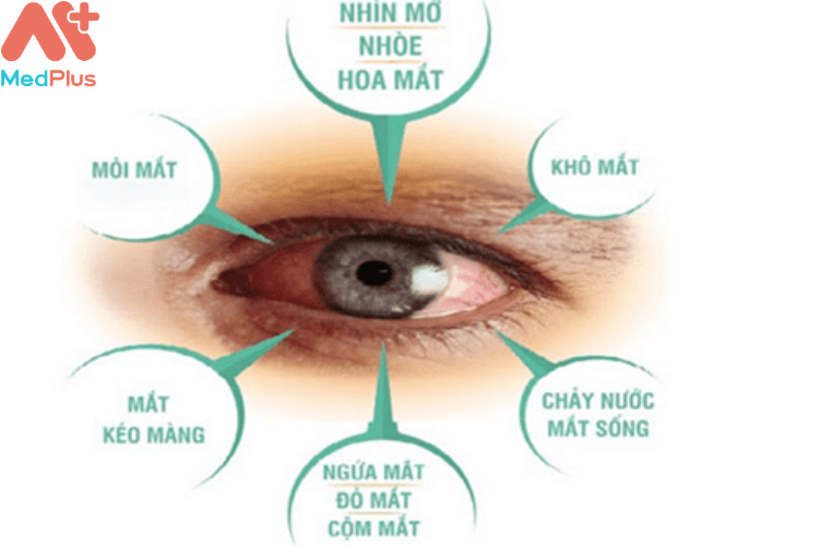 Triệu chứng của việc mờ mắt