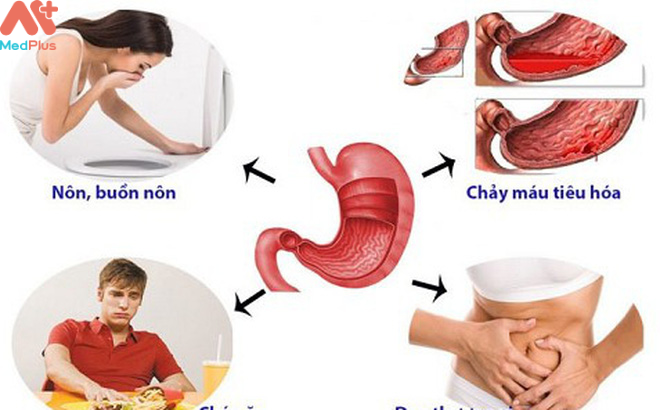 Các triệu chứng viêm dạ dày