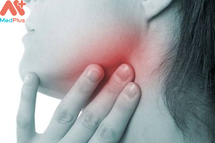 Tuyến giáp phình to là dấu hiệu của bệnh bướu cổ