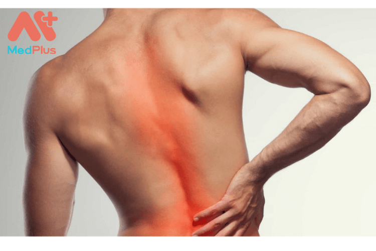 đau thắt lưng là gì