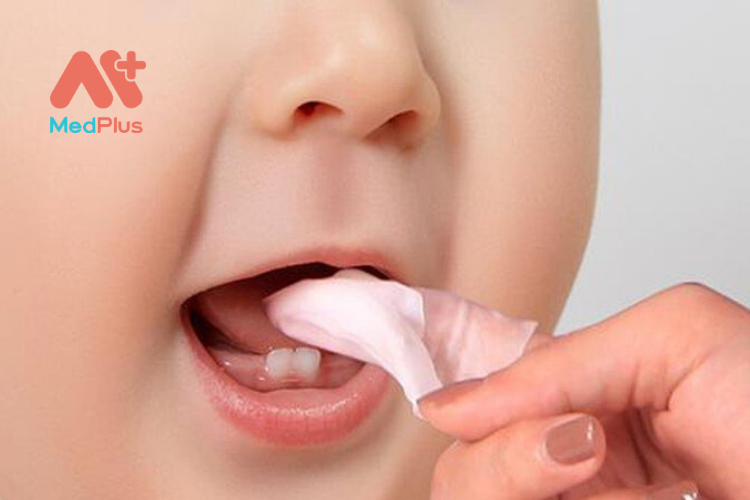 Điều trị cho trẻ bị nấm miệng