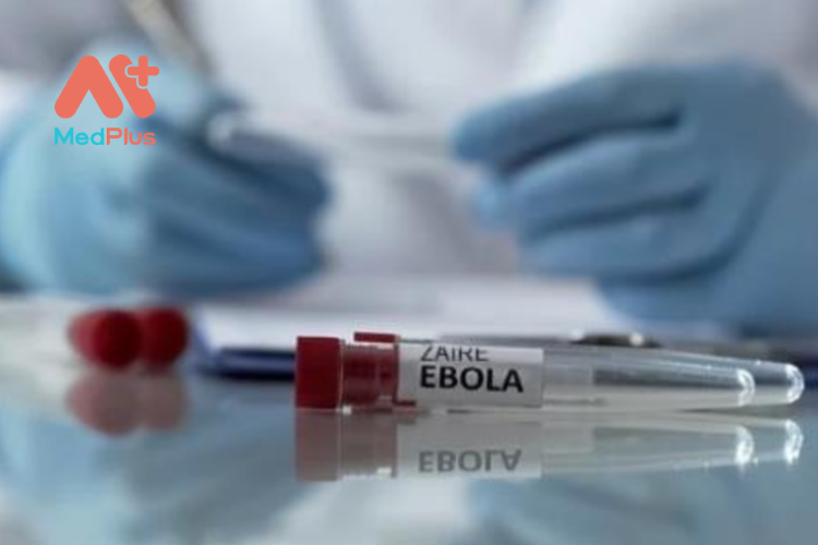 Điều trị cho trẻ bị nhiễm virus Ebola