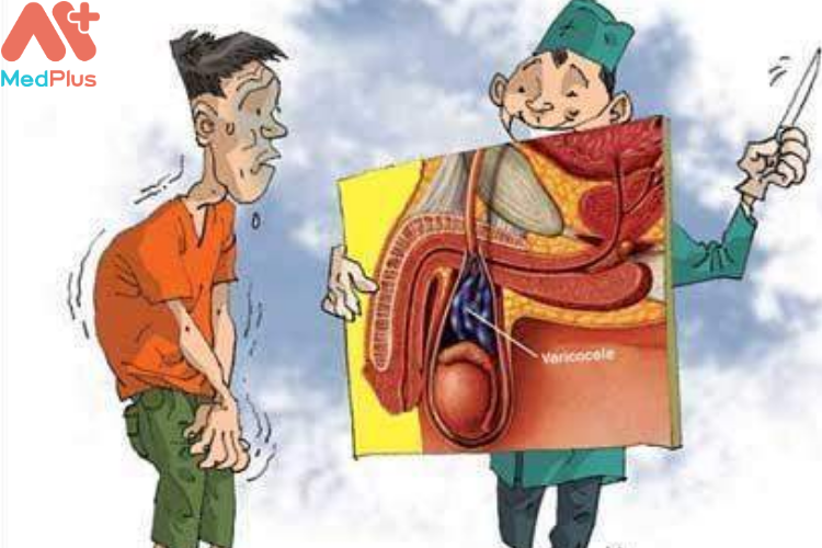 Nguyên nhân dẫn đến vô sinh ở nam