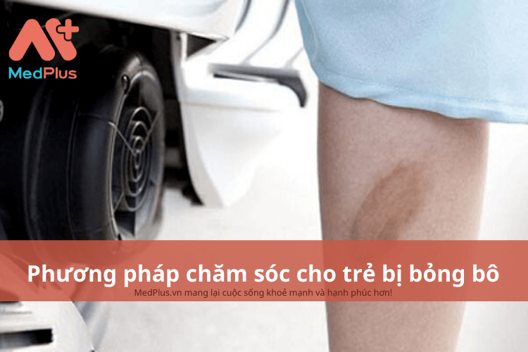 Phương pháp chăm sóc cho trẻ bị bỏng bô an toàn và hiệu quả