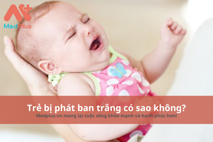 Phát ban trắng có liên quan đến việc tiếp xúc với hoá chất hay môi trường ô nhiễm không?
