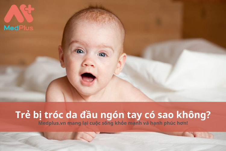 trẻ bị tróc da đầu ngón tay có sao không