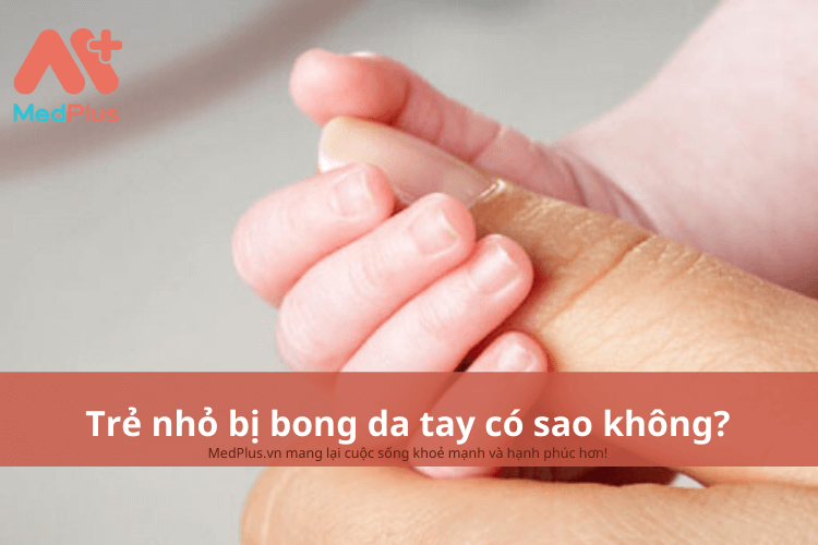 Trẻ nhỏ bị bong da tay có sao không?