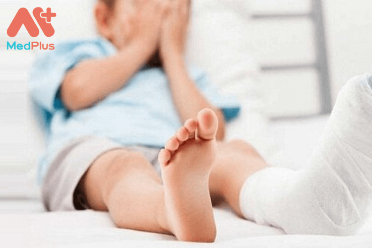 Trẻ nhỏ bị bong gân có sao không?