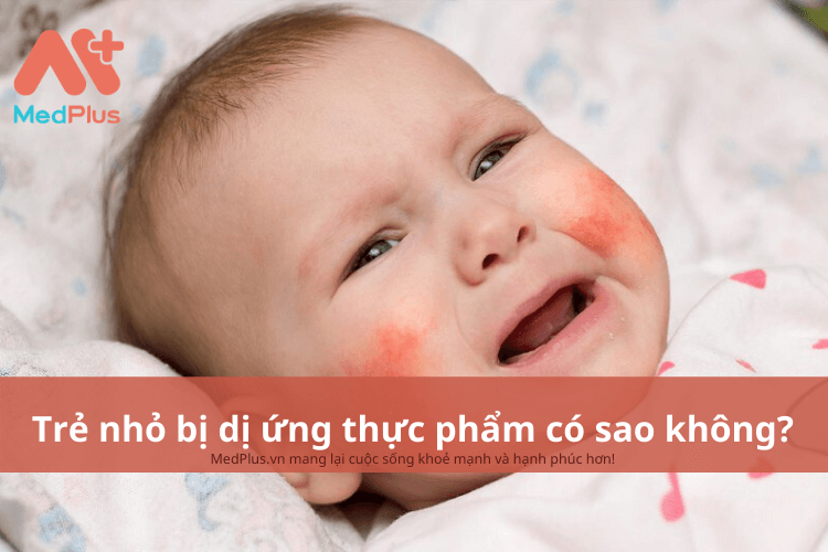 Trẻ nhỏ bị dị ứng thực phẩm có sao không?