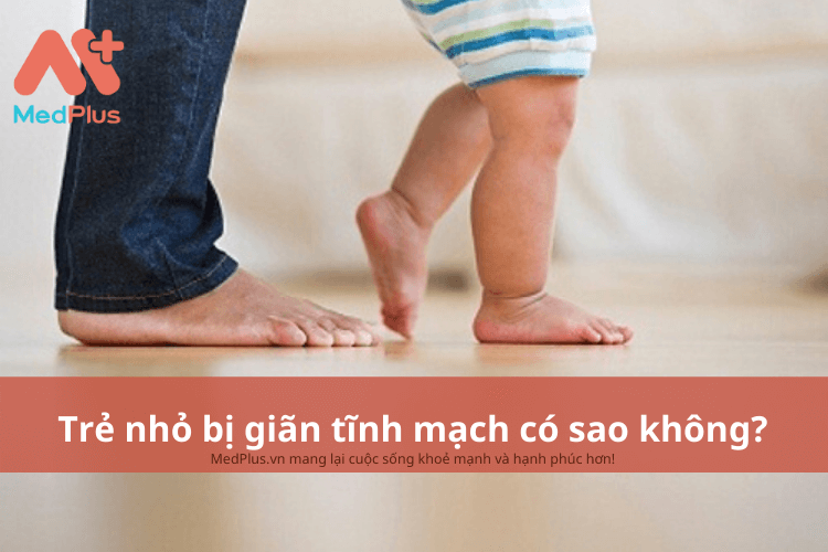 Trẻ nhỏ bị giãn tĩnh mạch có sao không?