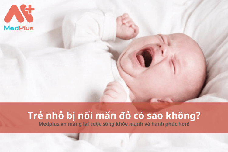 Trẻ nhỏ bị nổi mẩn đỏ có sao không