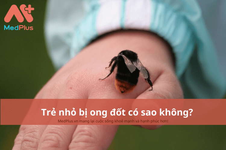 Trẻ nhỏ bị ong đốt có sao không?