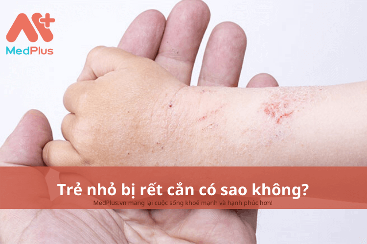 Trẻ nhỏ bị rết cắn có sao không? Những điều bố mẹ cần biết