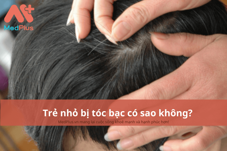 Trẻ nhỏ bị tóc bạc có sao không? Những điều bố mẹ cần biết 2 Trẻ nhỏ bị tóc bạc có sao không?