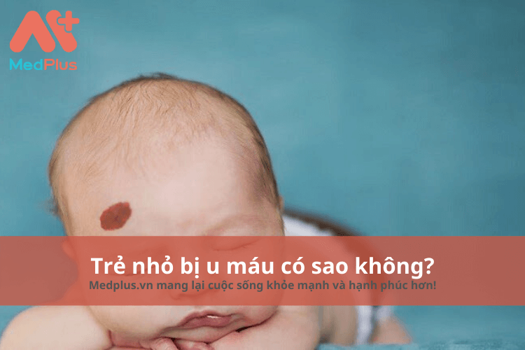 Trẻ nhỏ bị u máu có sao không