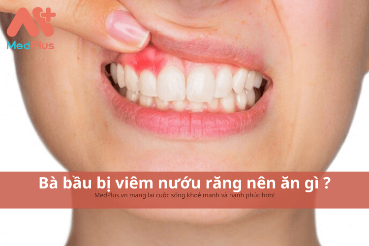 Bà bầu bị viêm nướu răng nên ăn gì ?