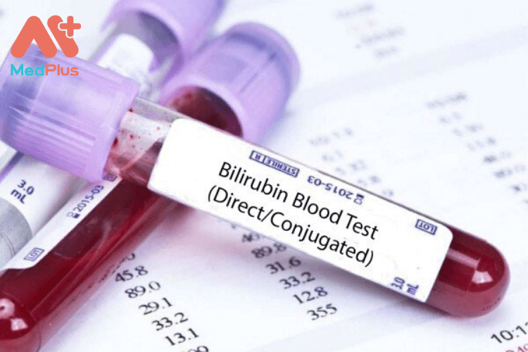 Bilirubin
