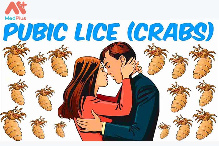Pubic Lice - Medplus