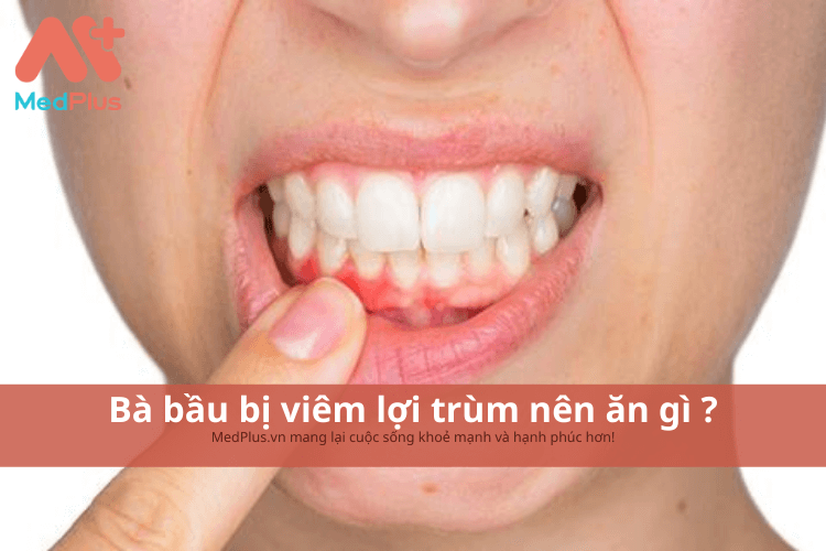 Bà bầu bị viêm lợi trùm nên ăn gì