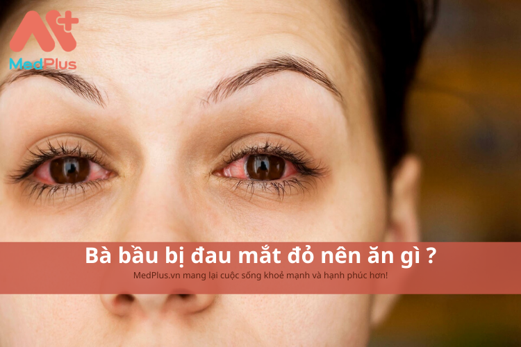 Bà bầu bị đau mắt đỏ nên ăn gì