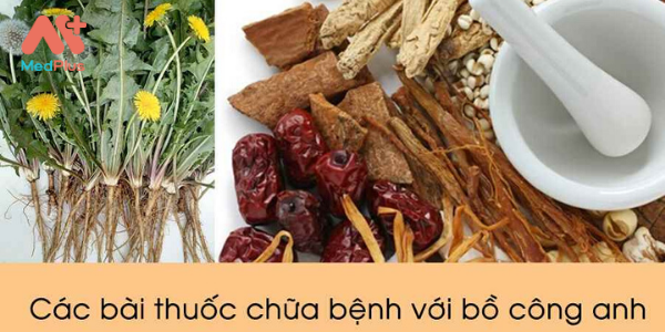 Đặc điểm Bồ Công Anh