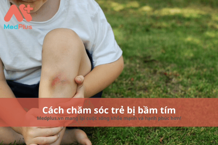 Cách chăm sóc trẻ bị bầm tím