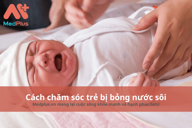 Cách chăm sóc trẻ bị bỏng nước sôi