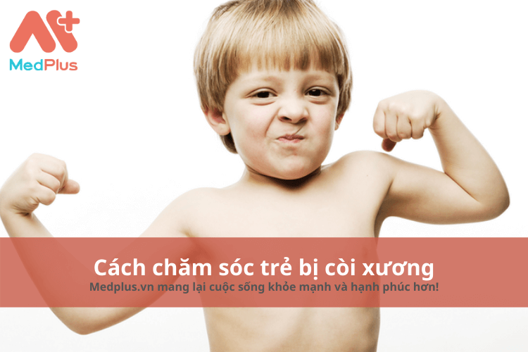 cách chăm sóc trẻ bị còi xương