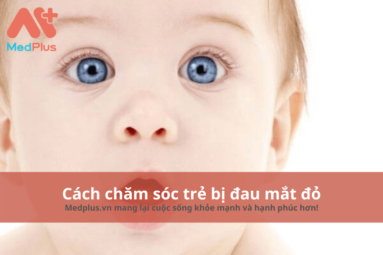 Chăm sóc cho trẻ bị đau mắt đỏ