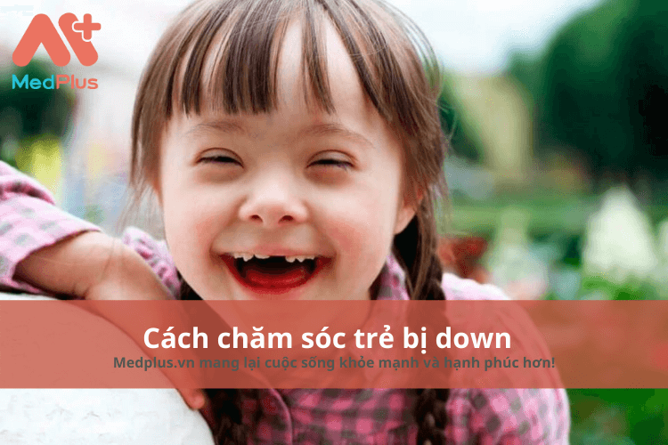 Cách chăm sóc trẻ bị down