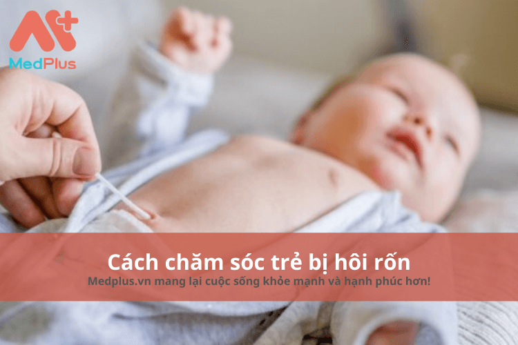 Cách chăm sóc trẻ bị hôi rốn