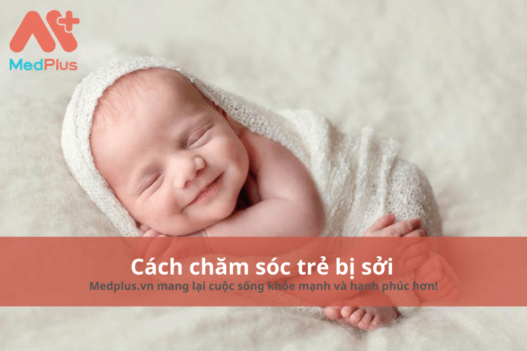 cách chăm sóc trẻ bị sởi