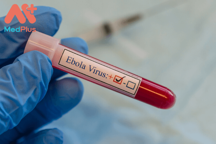 vắc xin phòng ngừa virus Ebola