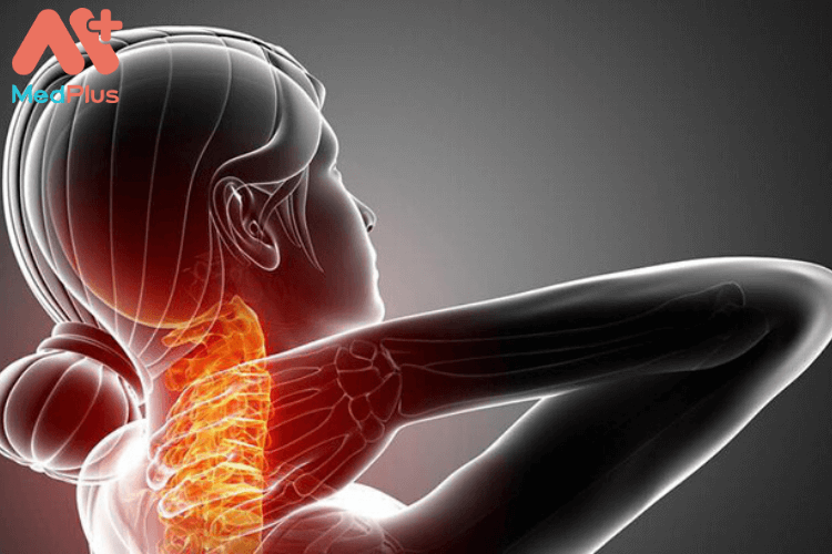 3 giai đoạn của bệnh đau vai gáy điều trị như thế nào? 127 3 giai đoạn của bệnh đau vai gáy điều trị như thế nào?