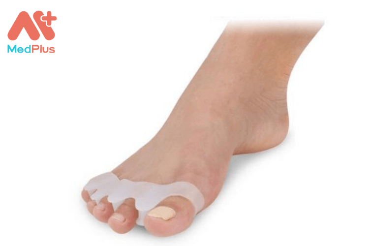 Ngón chân hình búa
