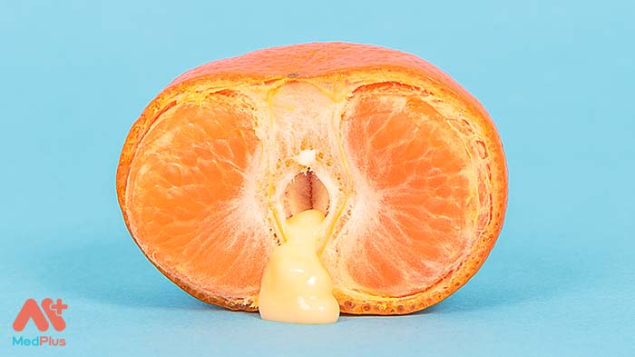 Nhiễm khuẩn Mycoplasma: Bệnh tình dục mới cần cảnh giác 131 khí hư âm đạo