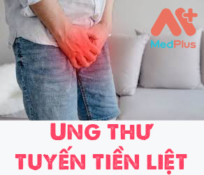 Những điều cần biết về Ung thư tuyến tiền liệt
