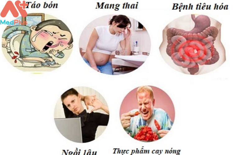 Các nguyên nhân chính dẫn đến bệnh lòi trĩ