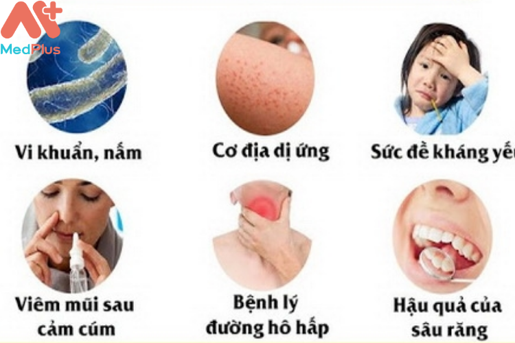 Các nguyên nhân chủ yếu gây viêm xoang