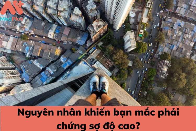 nguyen nhan khien ban mac phai chung so do cao - Medplus